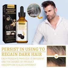 SERUM ANTI CANAS-PRODUCTO PREMIUM